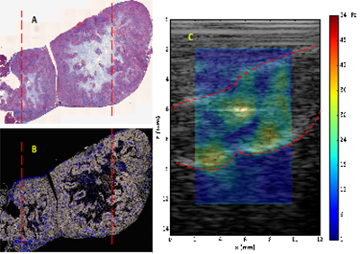 Pancreatic cancer imaging example.